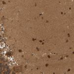 BAHCC1 Polyclonal Antibody