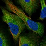 CCDC43 Polyclonal Antibody