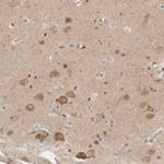 CCDC43 Antibody in Immunohistochemistry (Paraffin) (IHC (P))