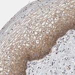 CCDC43 Antibody in Immunohistochemistry (Paraffin) (IHC (P))