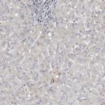 CCDC43 Antibody in Immunohistochemistry (Paraffin) (IHC (P))