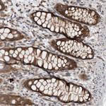CCDC43 Antibody in Immunohistochemistry (Paraffin) (IHC (P))