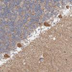 C17orf53 Antibody in Immunohistochemistry (IHC)