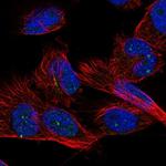 ZNF77 Polyclonal Antibody