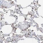 ZNF77 Antibody in Immunohistochemistry (Paraffin) (IHC (P))
