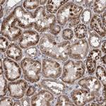 ZNF324B Antibody in Immunohistochemistry (Paraffin) (IHC (P))