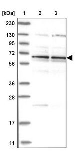 ZNF324B Antibody in Western Blot (WB)