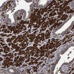 V-ATPase H Antibody in Immunohistochemistry (IHC)