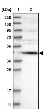 SCRN2 Antibody in Western Blot (WB)