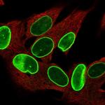 ZNF665 Antibody in Immunocytochemistry (ICC/IF)