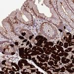 ZNF665 Antibody in Immunohistochemistry (Paraffin) (IHC (P))