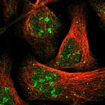 ZBTB37 Polyclonal Antibody