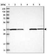 ZBTB37 Antibody in Western Blot (WB)