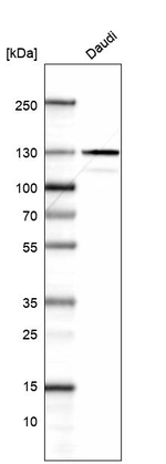 DDX42 Antibody in Western Blot (WB)