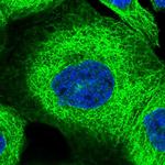 ZNF347 Polyclonal Antibody