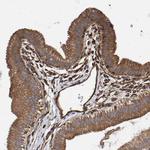 ZNF347 Antibody in Immunohistochemistry (IHC)