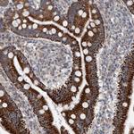 ZNF566 Antibody in Immunohistochemistry (Paraffin) (IHC (P))