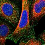 MGC87631 Antibody in Immunocytochemistry (ICC/IF)