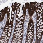 MGC87631 Antibody in Immunohistochemistry (Paraffin) (IHC (P))