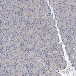 ACRC Antibody in Immunohistochemistry (IHC)