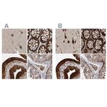 KIAA0753 Antibody in Immunohistochemistry (IHC)