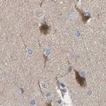 KIAA0753 Antibody in Immunohistochemistry (IHC)