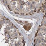 KIAA0753 Antibody in Immunohistochemistry (IHC)