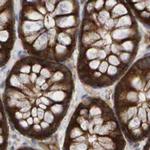 KIAA0753 Antibody in Immunohistochemistry (IHC)