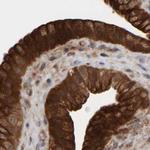 KIAA0753 Antibody in Immunohistochemistry (IHC)