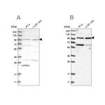 KIAA0753 Antibody in Western Blot (WB)