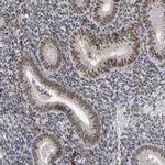 ATF7IP Antibody in Immunohistochemistry (Paraffin) (IHC (P))