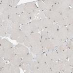 ATF7IP Antibody in Immunohistochemistry (Paraffin) (IHC (P))