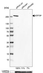 ATF7IP Antibody