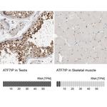 ATF7IP Antibody in Immunohistochemistry (IHC)