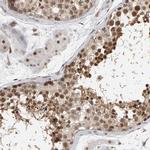 ATF7IP Antibody in Immunohistochemistry (IHC)