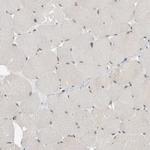 ATF7IP Antibody in Immunohistochemistry (IHC)