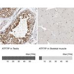 ATF7IP Antibody