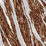 TTI2 Antibody in Immunohistochemistry (Paraffin) (IHC (P))