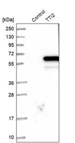 TTI2 Antibody in Western Blot (WB)