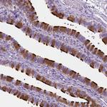 EFCAB1 Antibody in Immunohistochemistry (IHC)