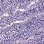 EFCAB1 Antibody in Immunohistochemistry (IHC)