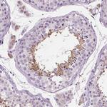 EFCAB1 Antibody in Immunohistochemistry (IHC)