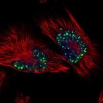 SON Polyclonal Antibody