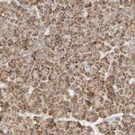 APBB2 Antibody in Immunohistochemistry (Paraffin) (IHC (P))