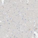 DUOX1 Polyclonal Antibody