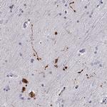 RUNDC3A Antibody in Immunohistochemistry (IHC)