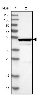 RUNDC3A Antibody in Western Blot (WB)