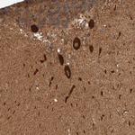 SYNRG Antibody in Immunohistochemistry (Paraffin) (IHC (P))