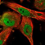 TRIM8 Polyclonal Antibody