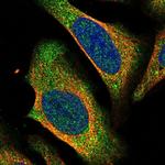 CtBP2 Polyclonal Antibody